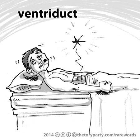 ventriduct